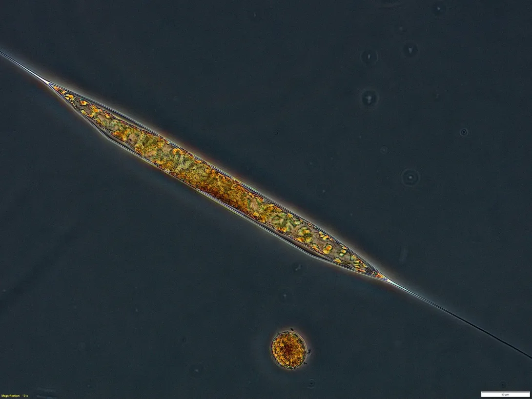 Phytoplankton (Rhizosolenia)
